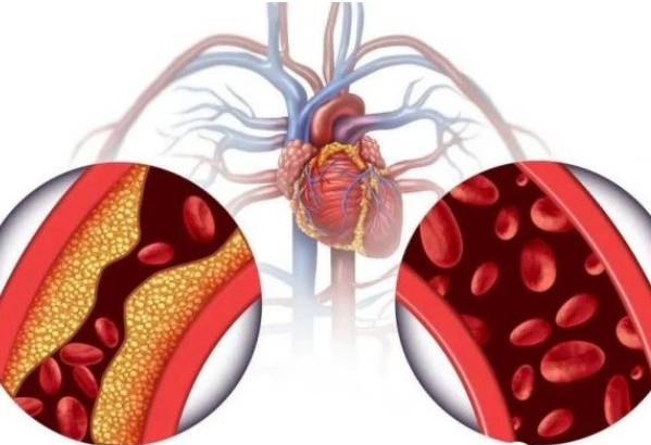 王涛博士：心脑血管疾病的根本原因是肝脏的脂类代谢异常